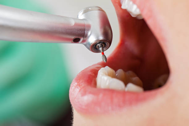 Best Urgent Dental Care for Toothache in Greenfield, IA